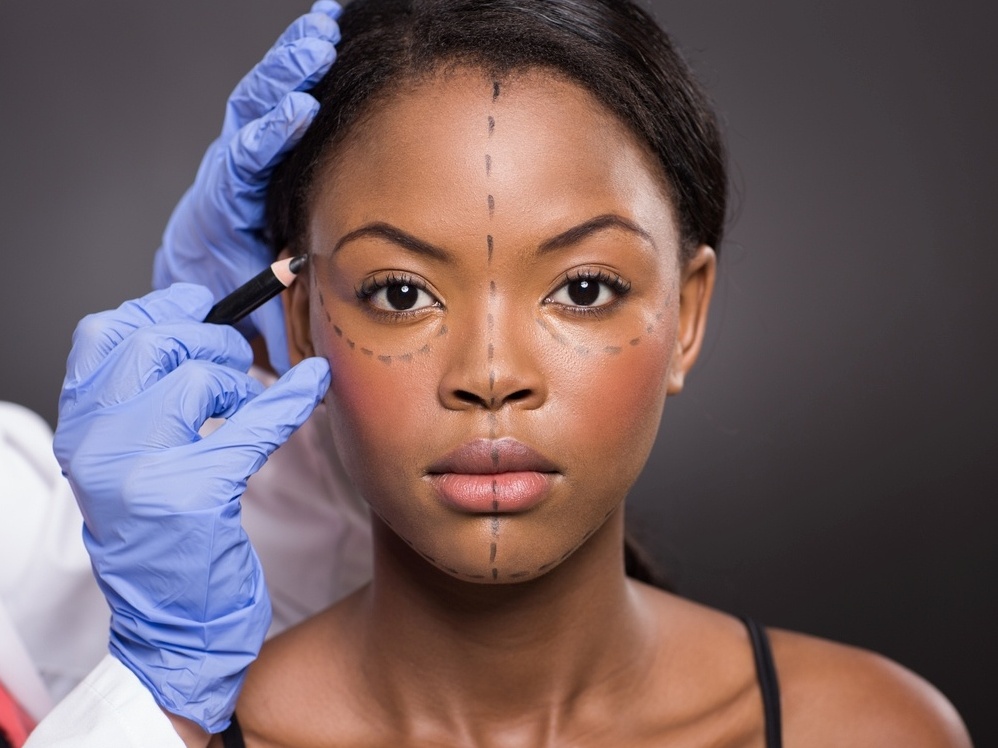 Under eye surgery